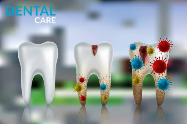 Tooth infection risks and treatment